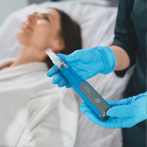 $399 VAMPIRE SPECIAL (MICRONEEDLING W/PRP)
