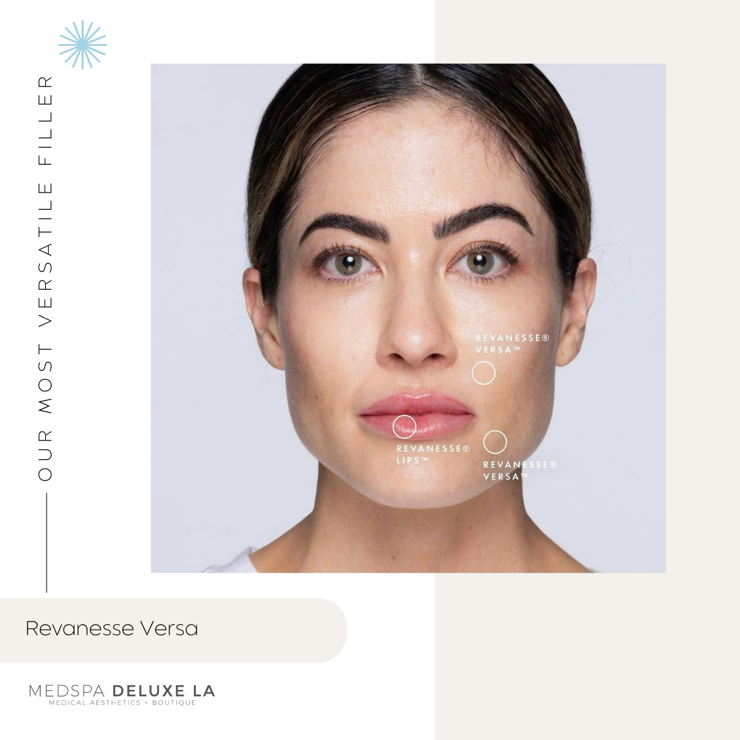 FILLER SPECIALS | BLACK FRIDAY 2025