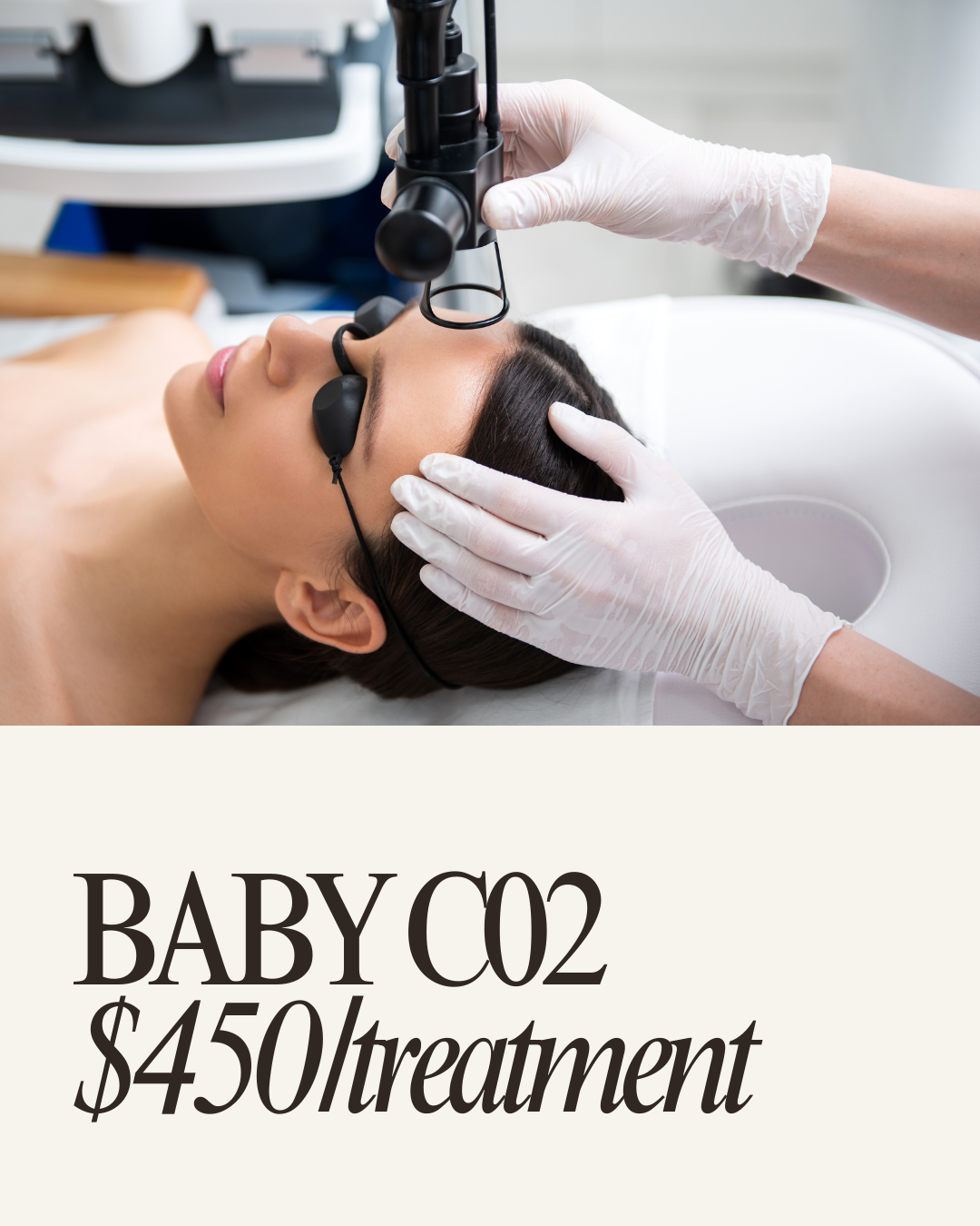 $450 BABY CO2 LASER