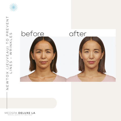 JEUVEAU BUY 40 GET 10 FREE UNITS  | FEBRUARY SPECIAL