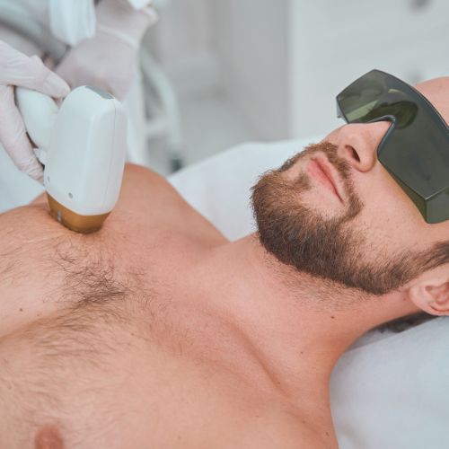 LASER HAIR REMOVAL: UP TO 25% OFF