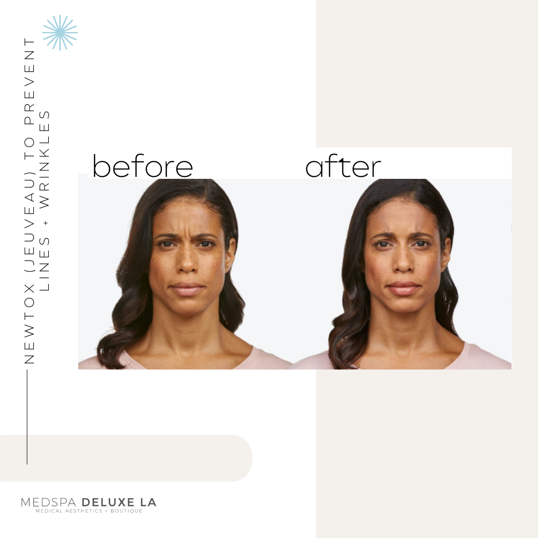 JEUVEAU BUY 40 GET 10 FREE UNITS  | FEBRUARY SPECIAL