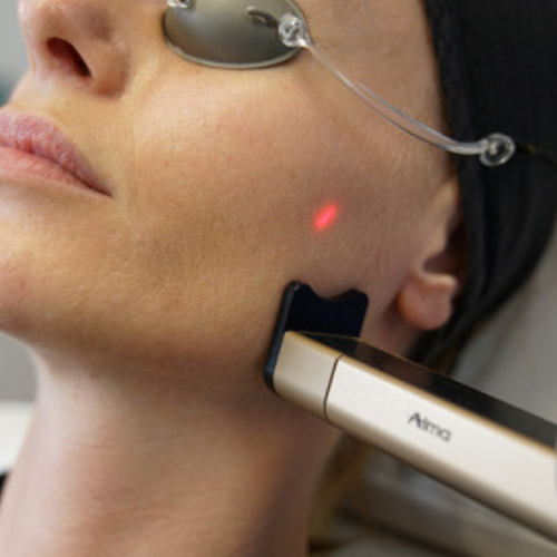 CO2  | BLACK FRIDAY 2025