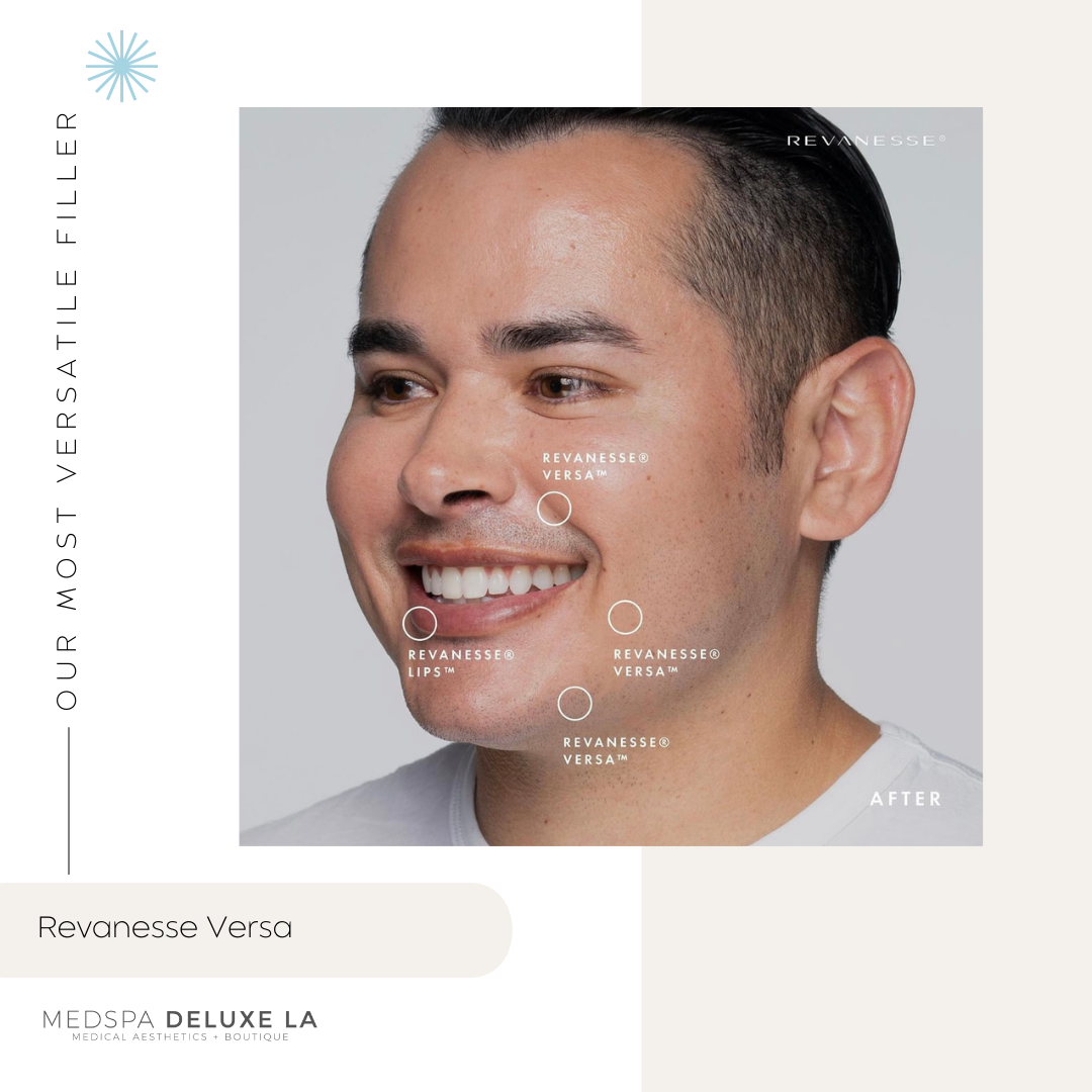 LIP FILLER | FEBRUARY 2026