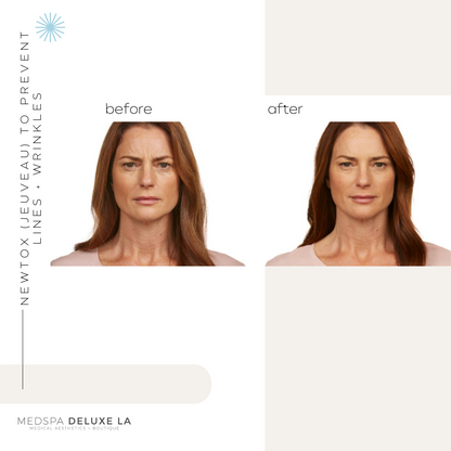 JEUVEAU BUY 40 GET 10 FREE UNITS  | FEBRUARY SPECIAL