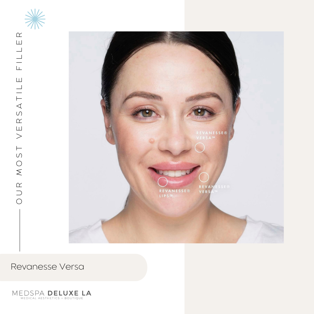 FILLER SPECIALS | BLACK FRIDAY 2025