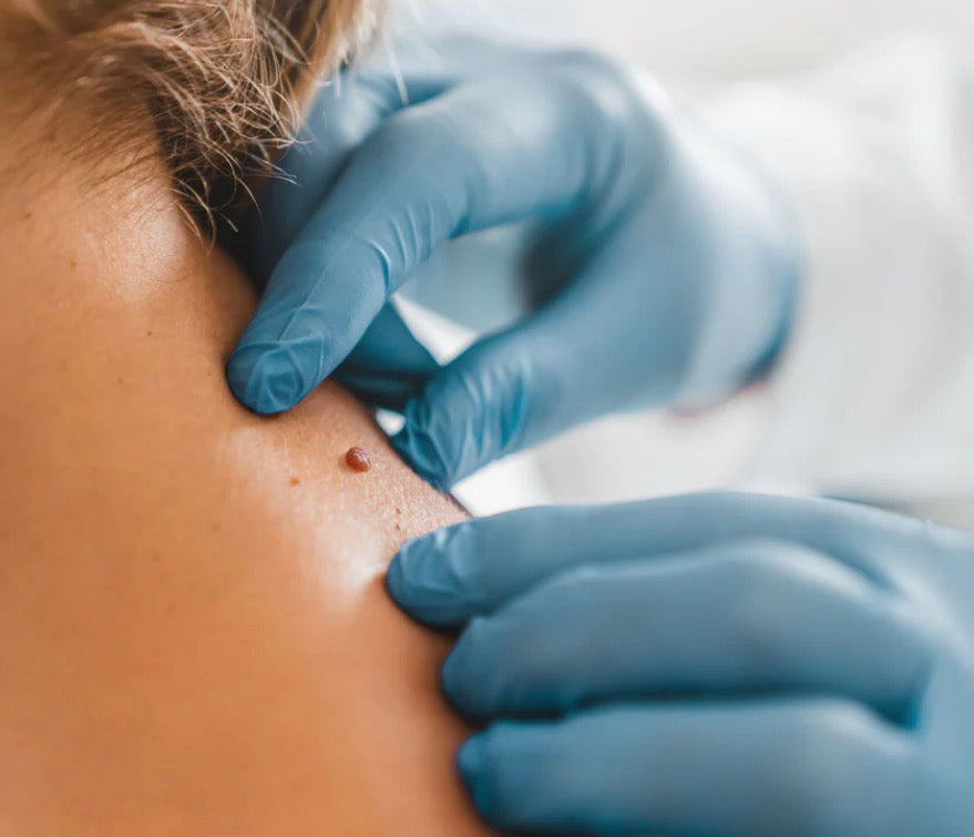 SKIN TAGS : BUY 7 GET 1 FREE : OCTOBER SPECIALS