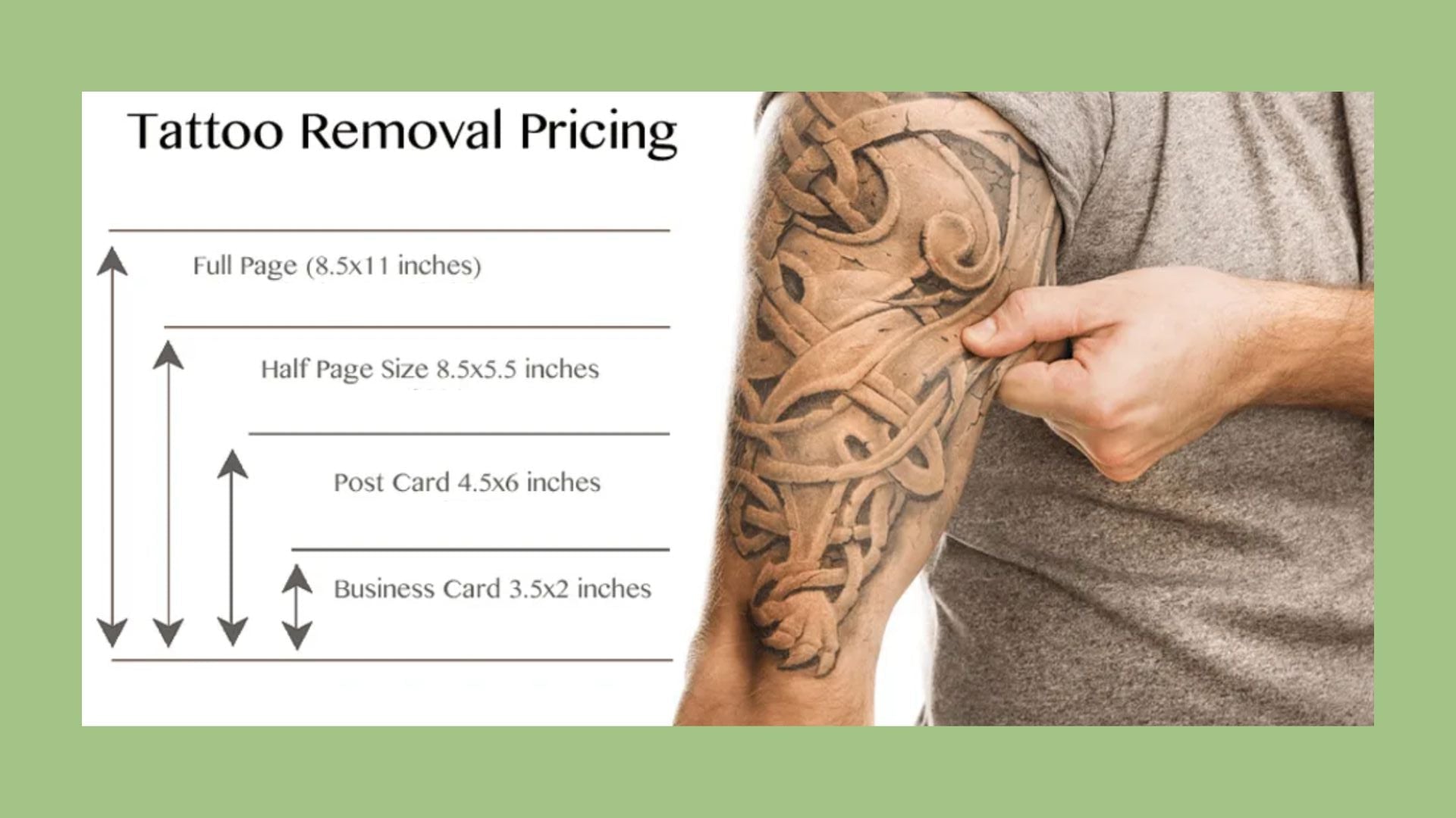 TATTOO REMOVAL | BLACK FRIDAY 2025