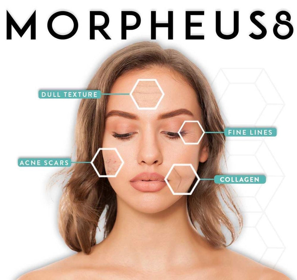 MORPHEUS8 SKIN TIGHTENING: FULL FACE- OCTOBER SPECIAL